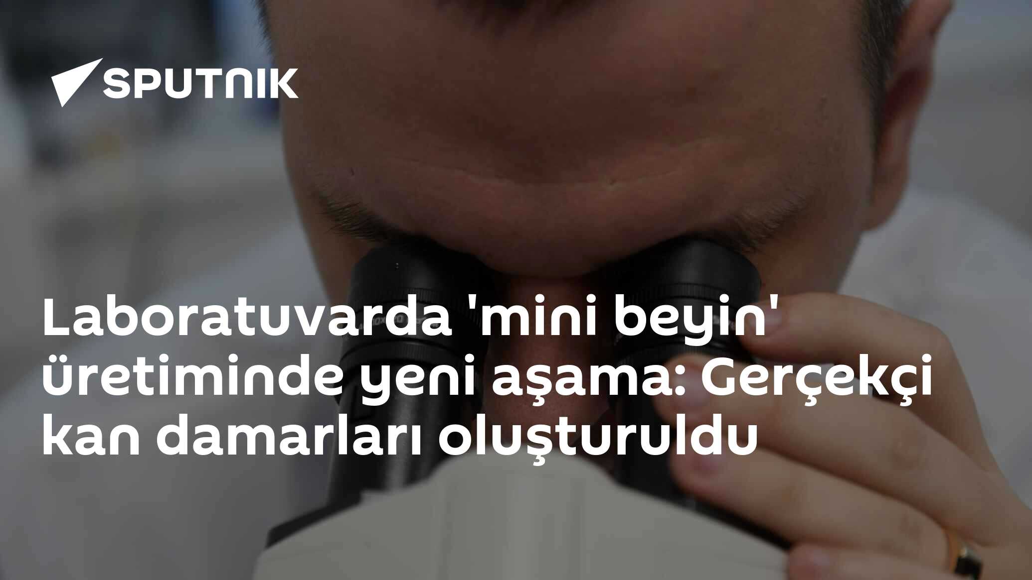 'Mini Beyinler' Üretimi: Yeni Bir Asama - Laboratuvarda Gerçek Beyne Benzer Kan Damarları