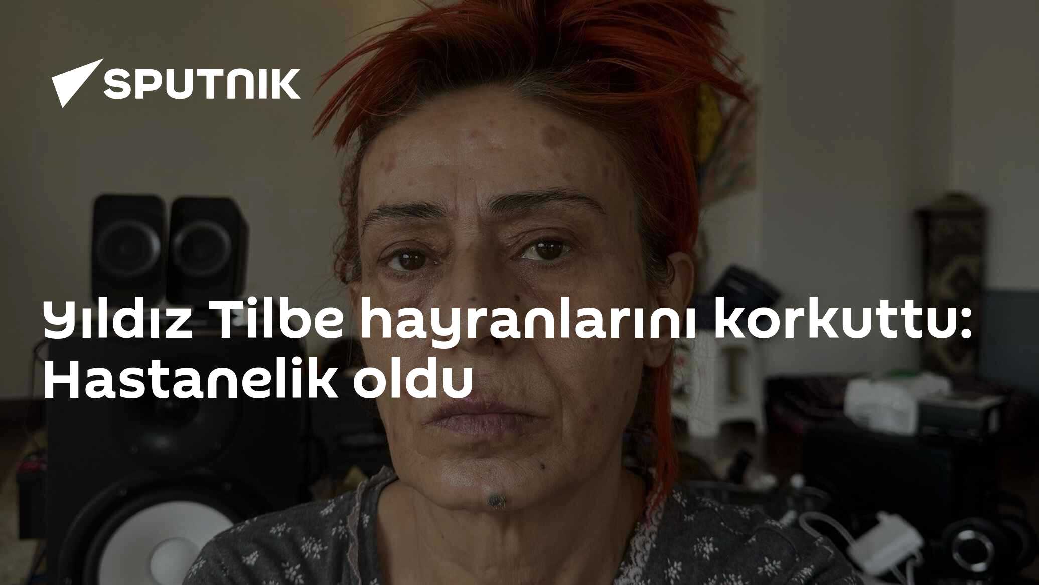 Yıldız Tilbe hayranlarını korkuttu: Hastanelik oldu