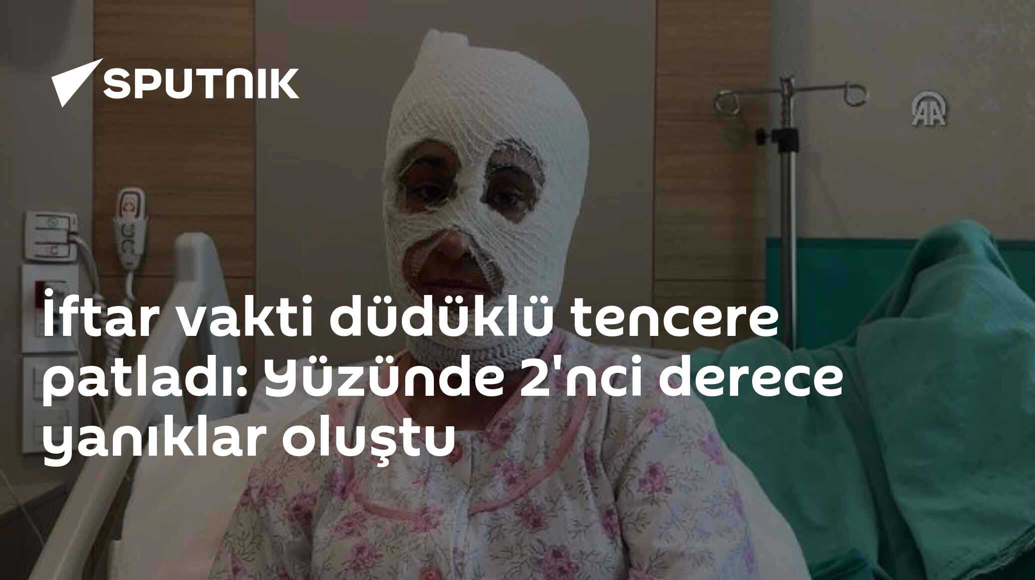 İftar Vakti Tencere Patladı: Yüzünde Yanık Oluştu