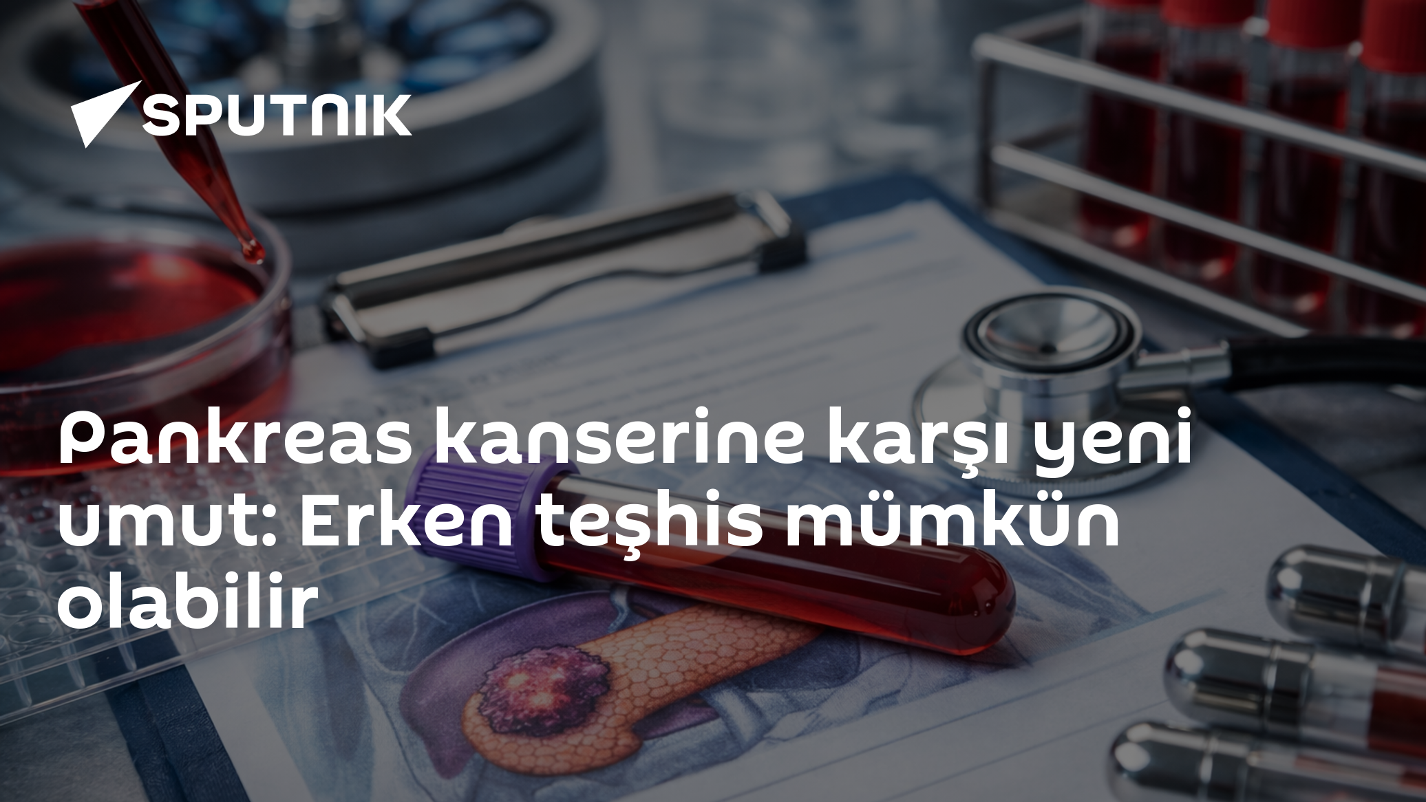 Pankreas kanserine karşı yeni umut: Erken teşhis mümkün olabilir