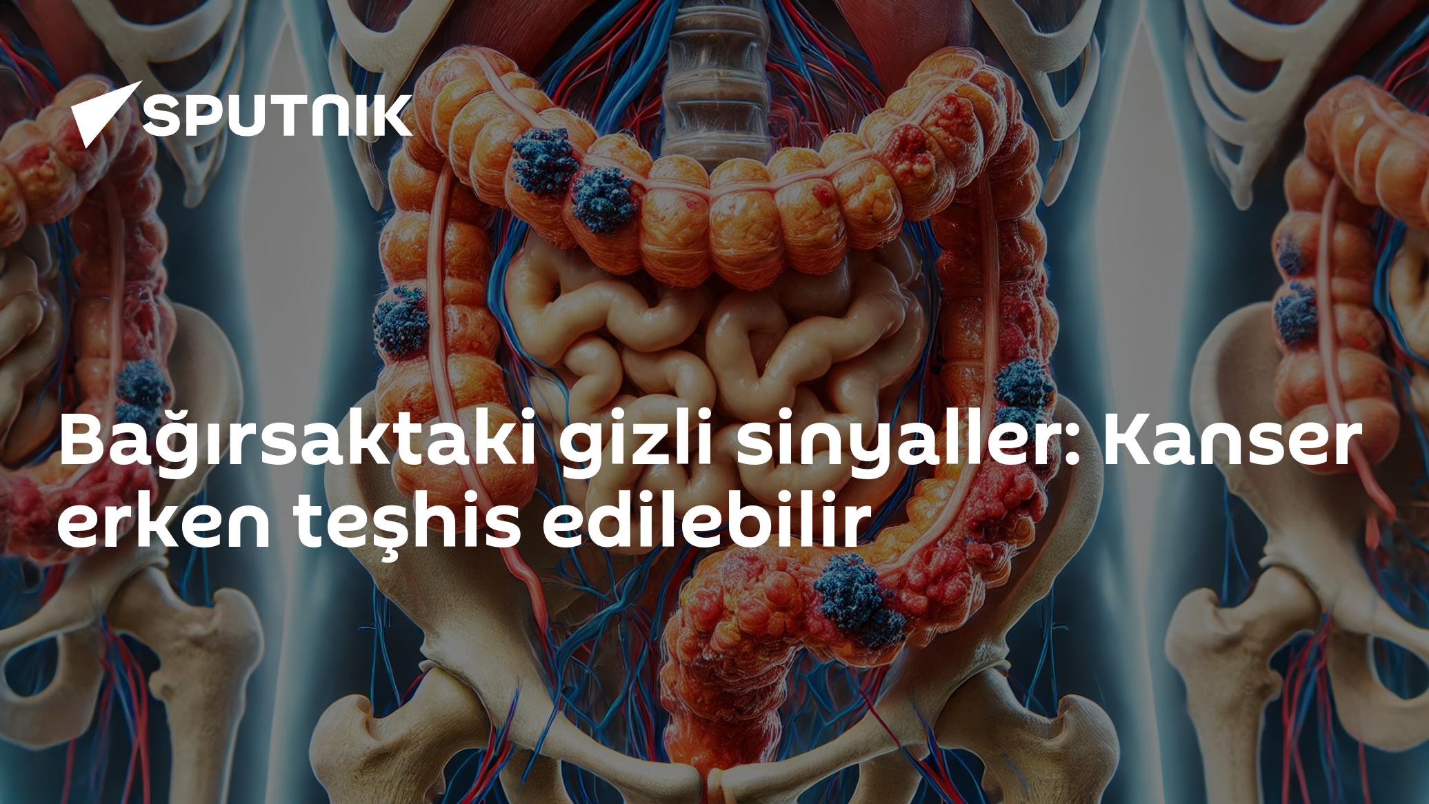 Bağırsaktaki gizli sinyaller: Kanser erken teşhis edilebilir
