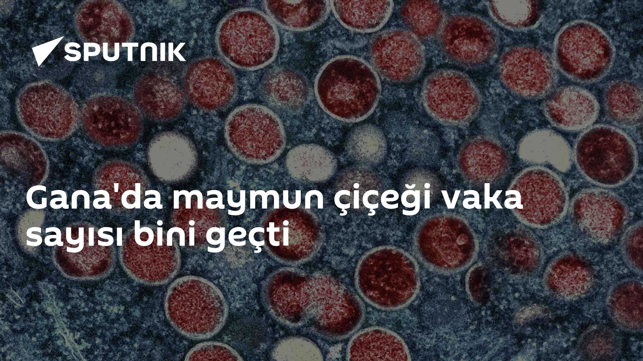Gana'da maymun çiçeği vaka sayısı bini geçti