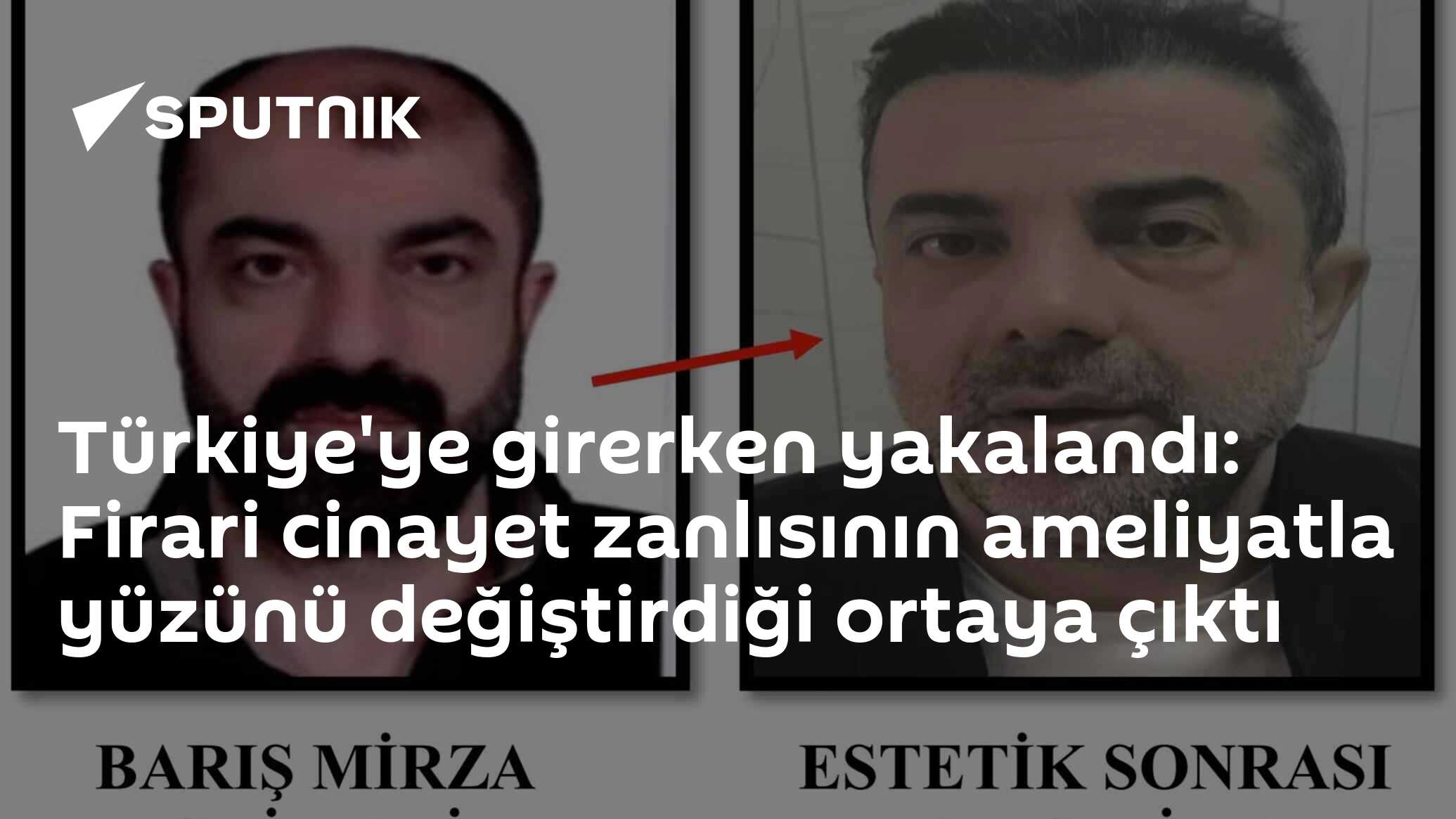 Türkiye'ye girerken yakalandı: Firari cinayet zanlısının ameliyatla yüzünü değiştirdiği ortaya çıktı