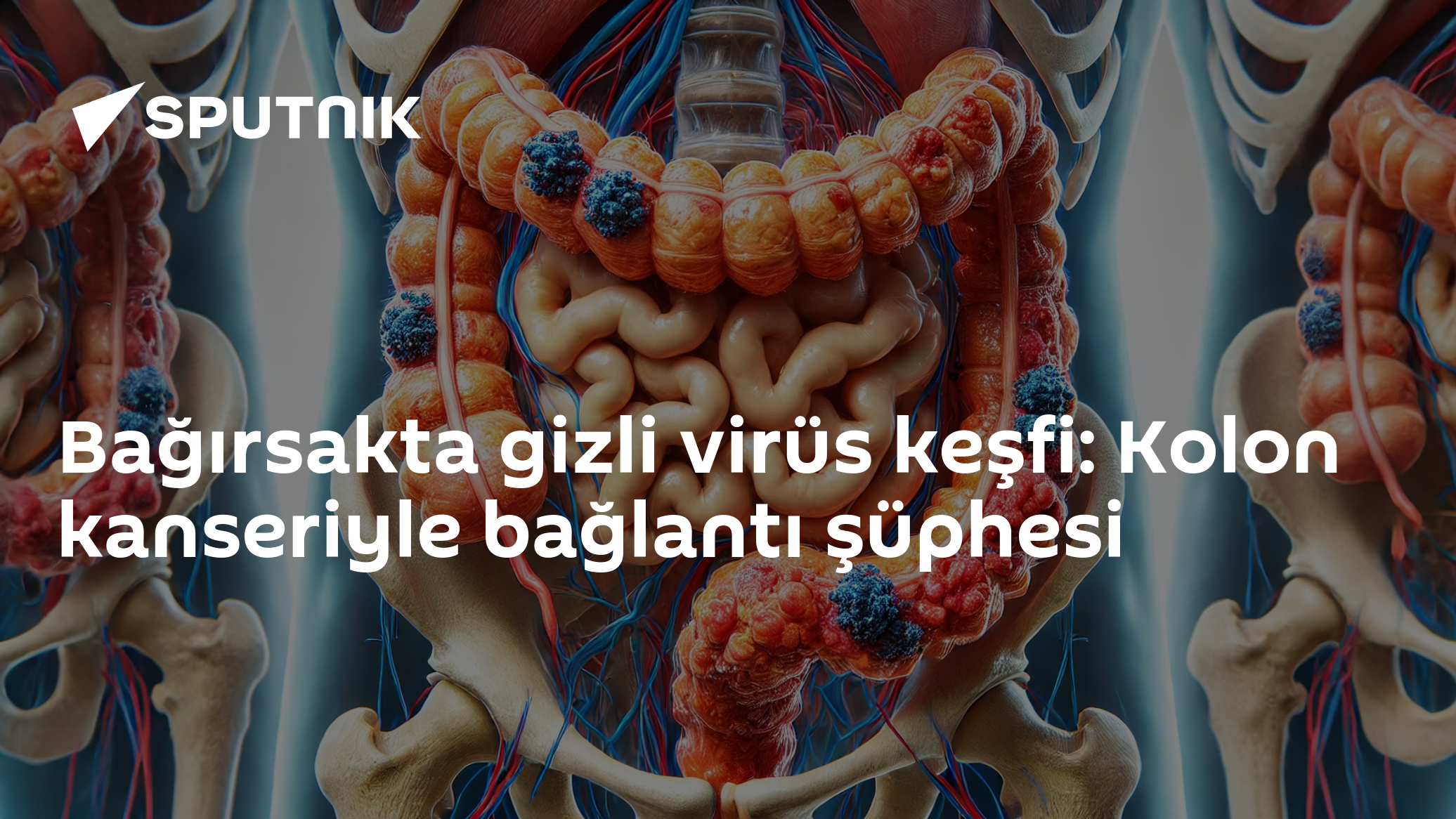 Bağırsakta gizli virüs keşfi: Kolon kanseriyle bağlantı şüphesi