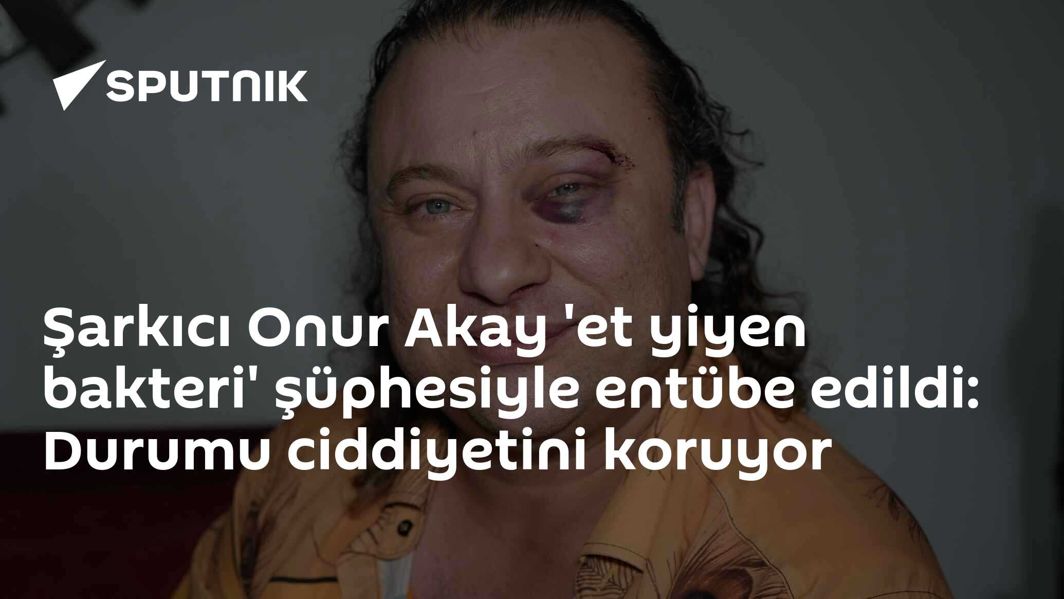 Pitbull saldırısına uğrayan şarkıcı Onur Akay entübe edildi: Et yiyen bakteri şüphesi