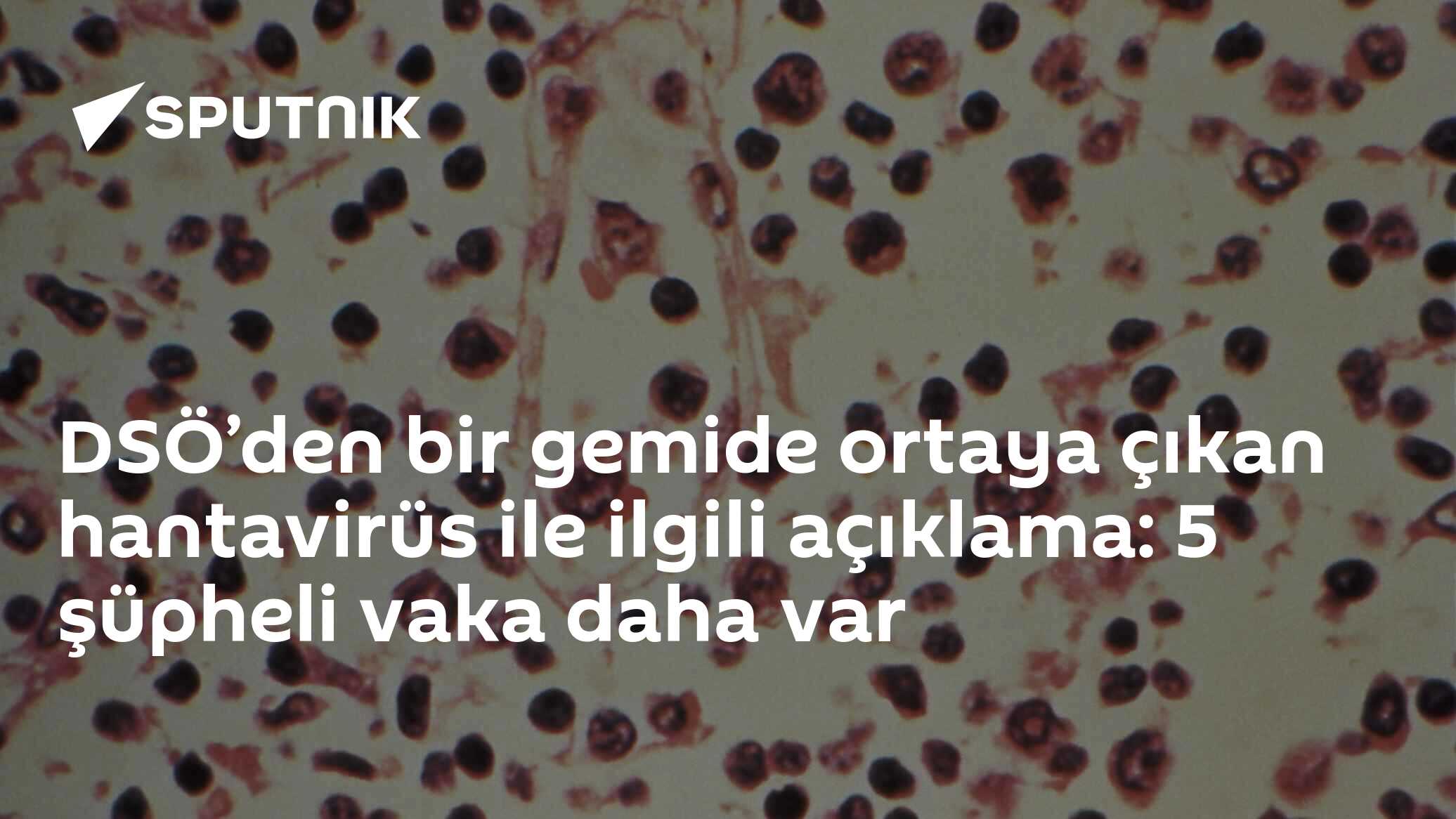 DSÖ’den bir gemide ortaya çıkan hantavirüs ile ilgili açıklama: 5 şüpheli vaka daha var