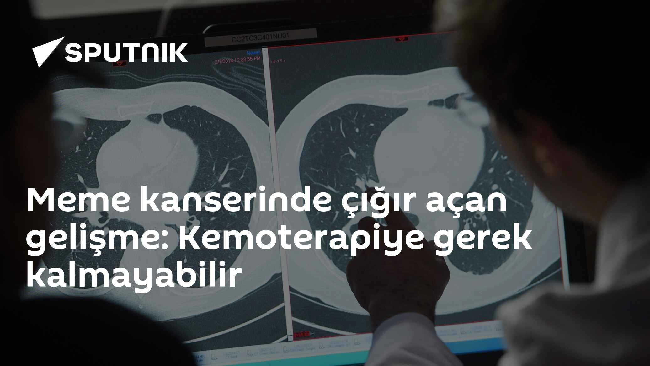 Meme kanserinde çığır açan gelişme: Kemoterapiye gerek kalmayabilir