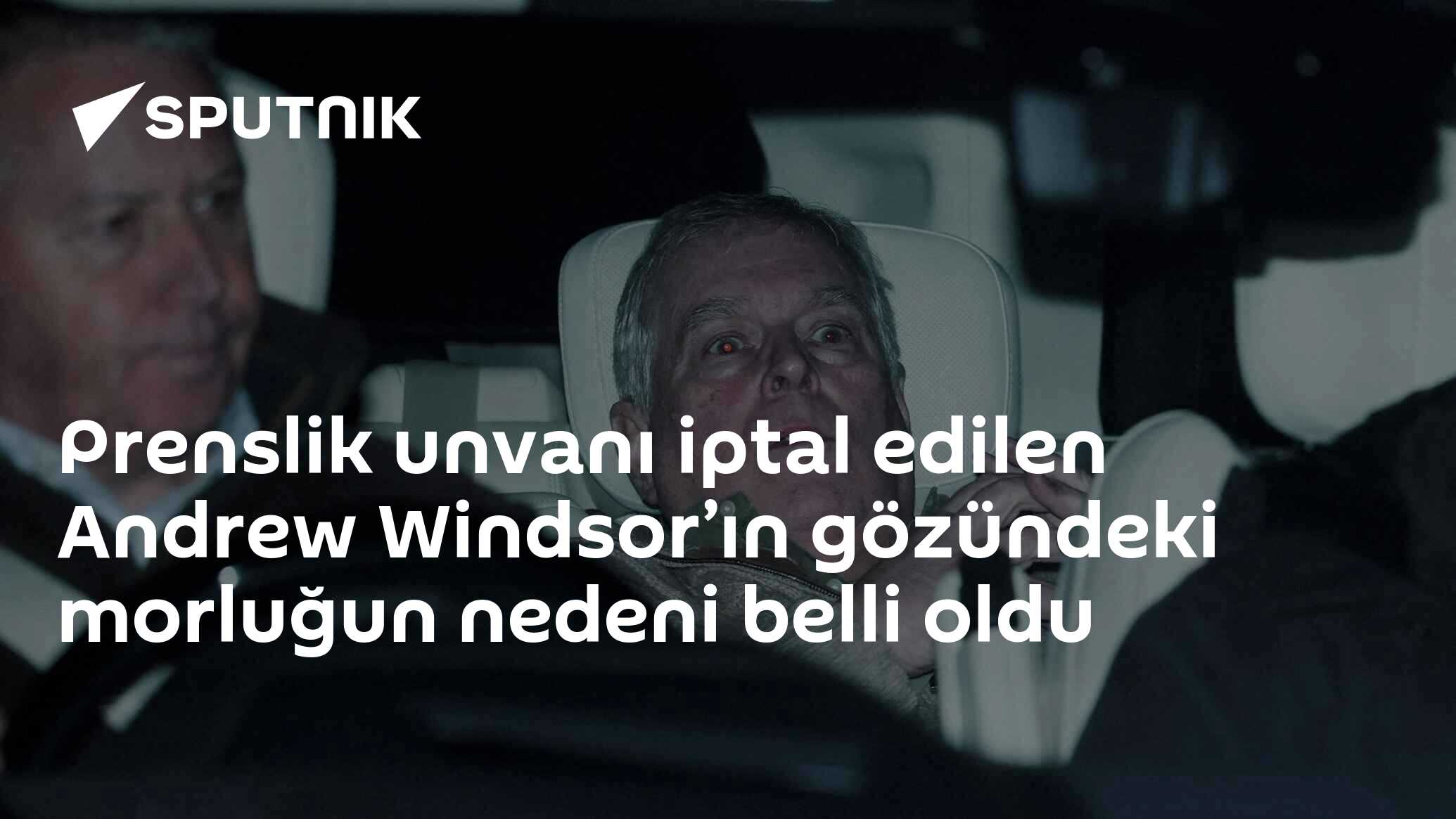 Prenslik unvanı iptal edilen Andrew Windsor’ın gözündeki morluğun nedeni belli oldu
