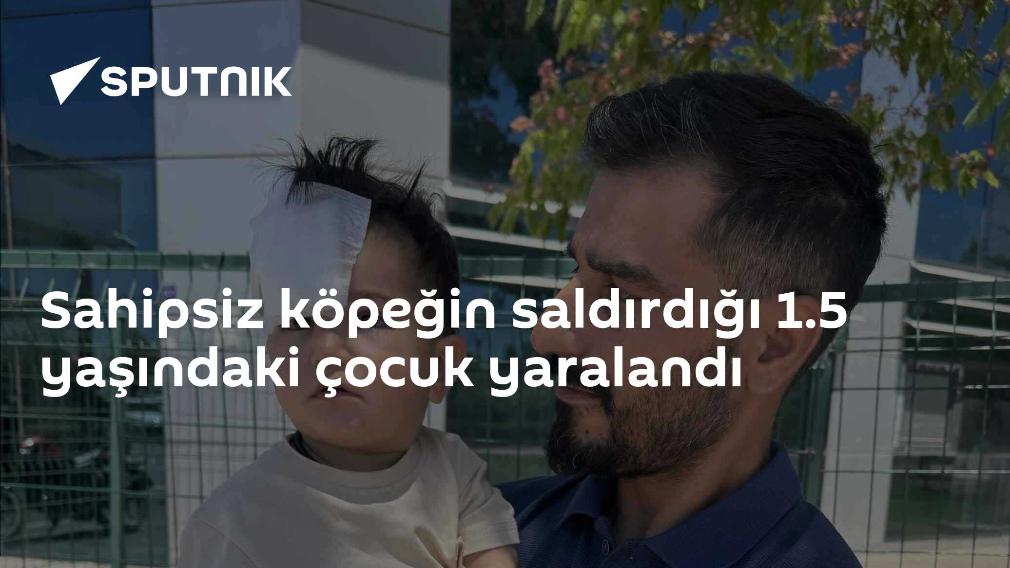 Sahipsiz köpeğin saldırdığı 1.5 yaşındaki çocuk yaralandı