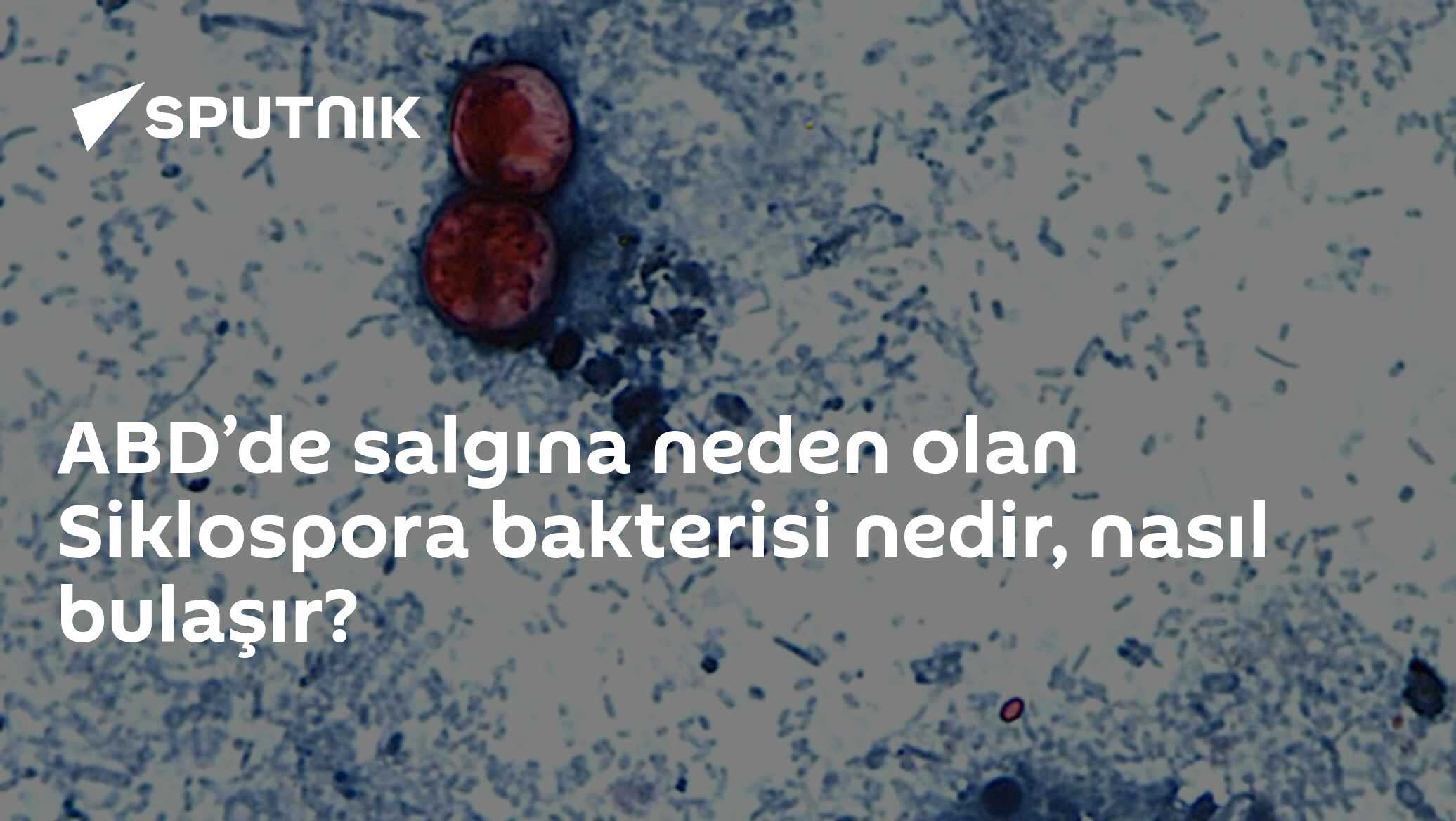 ABD’de salgına neden olan Siklospora bakterisi nedir, nasıl bulaşır?