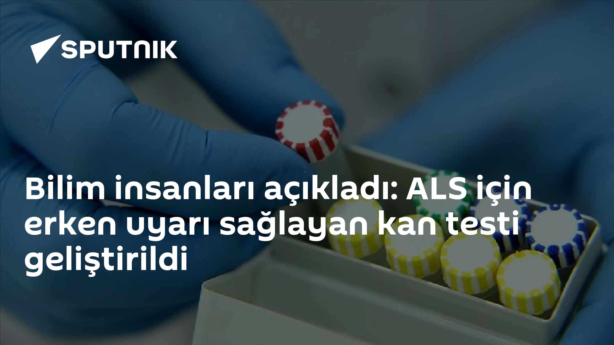 Bilim insanları ALS için erken uyarı sağlayan kan testi geliştirdi