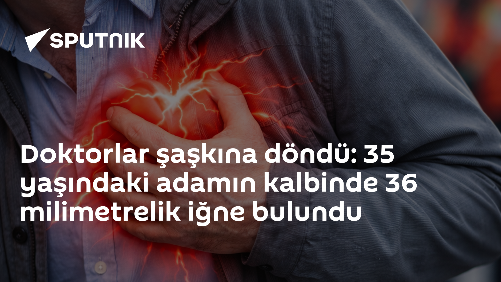 Doktorlar şaşkına döndü: 35 yaşındaki adamın kalbinde 36 milimetrelik iğne bulundu