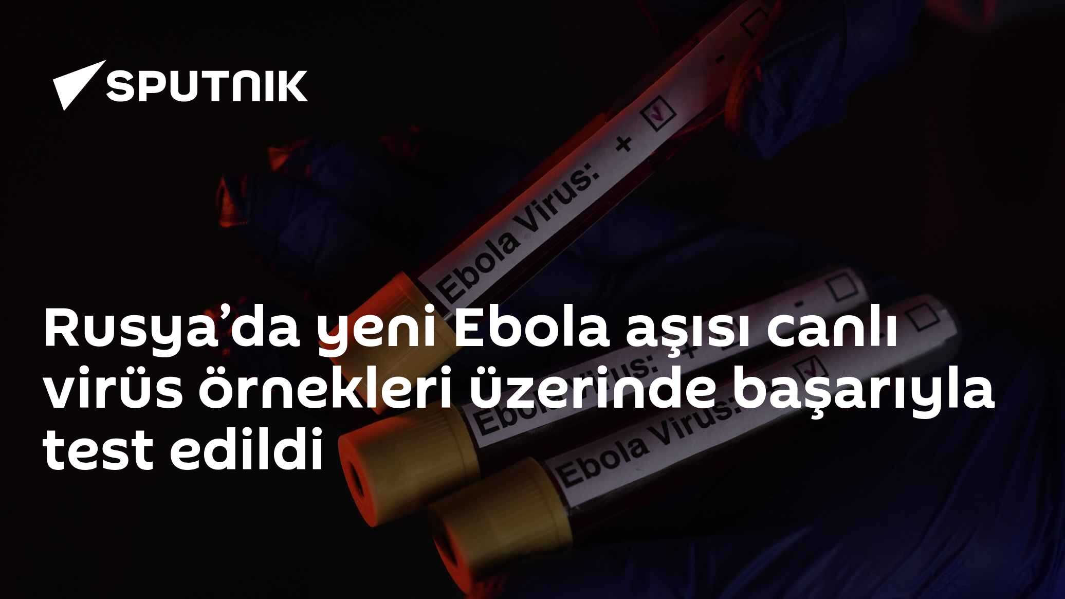 Rusya’da yeni Ebola aşısı canlı virüs örnekleri üzerinde başarıyla test edildi