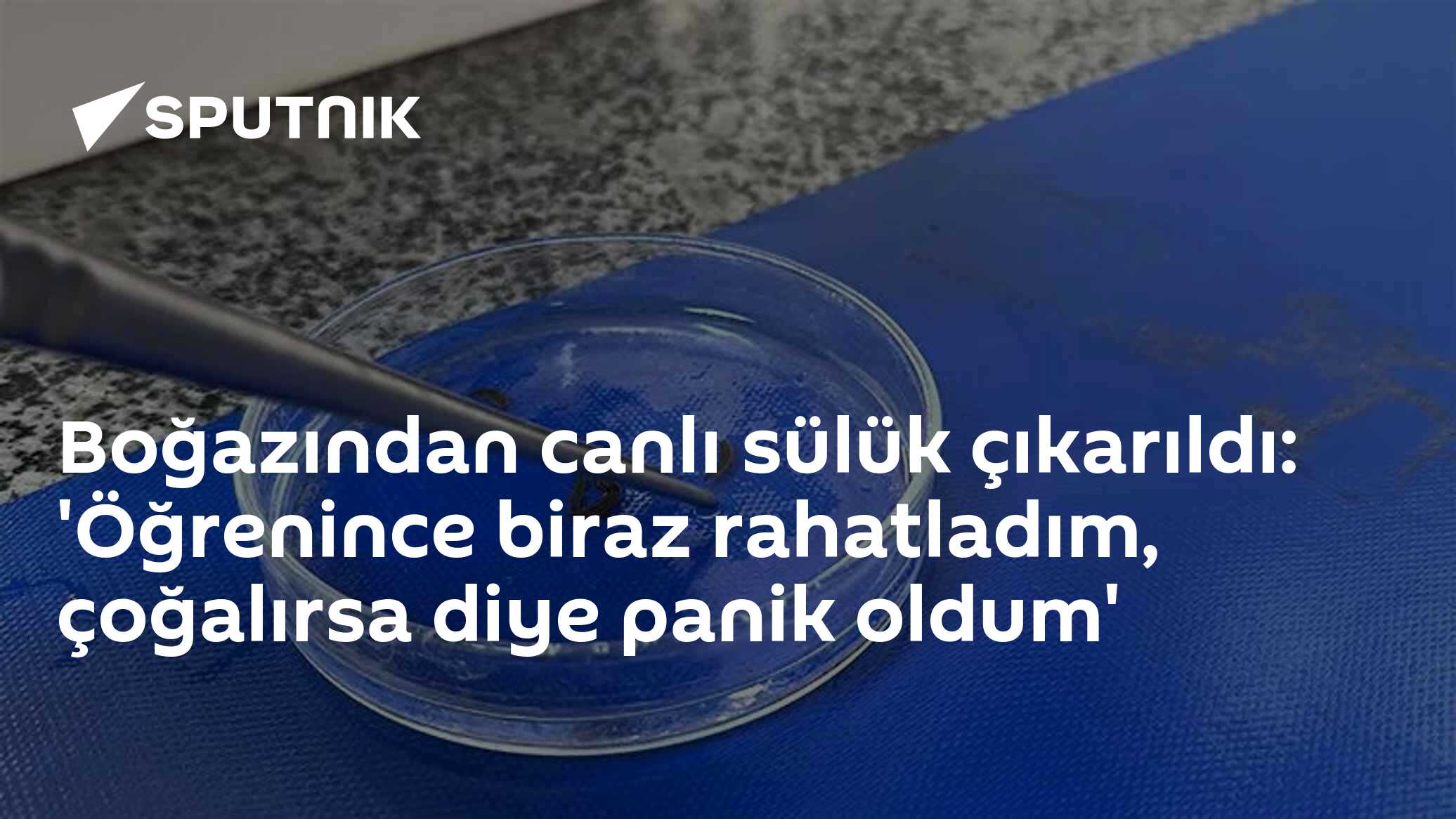 Boğazından canlı sülük çıkarıldı: 'Öğrenince biraz rahatladım, çoğalırsa diye panik oldum'