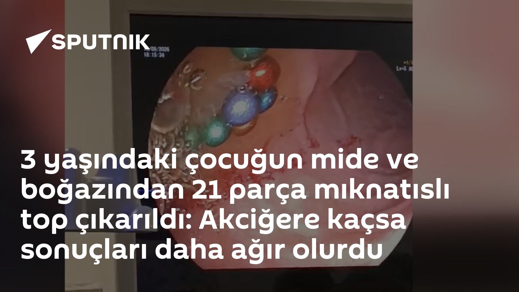 3 yaşındaki çocuğun mide ve boğazından 21 parça mıknatıslı top çıkarıldı: Akciğere kaçsa sonuçları daha ağır olurdu