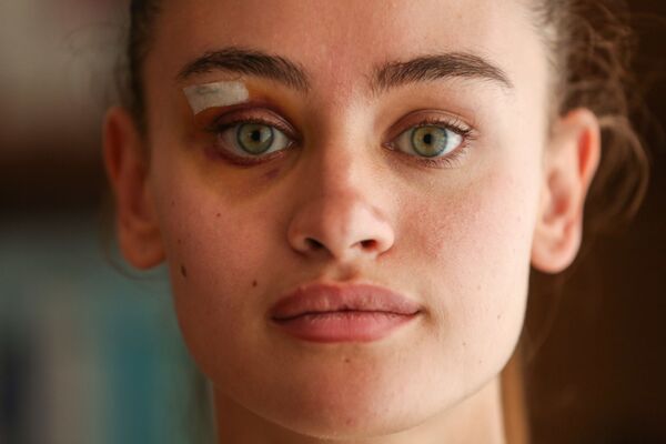 Ukraynalı model Daria ve erkek arkadaşı darp iddialarıyla ilgili ilk kez konuştu - Sputnik Türkiye