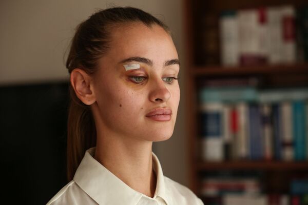 Ukraynalı model Daria ve erkek arkadaşı darp iddialarıyla ilgili ilk kez konuştu - Sputnik Türkiye