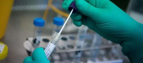 Koronavirüs testi Koronavirüs testi - Sputnik Türkiye