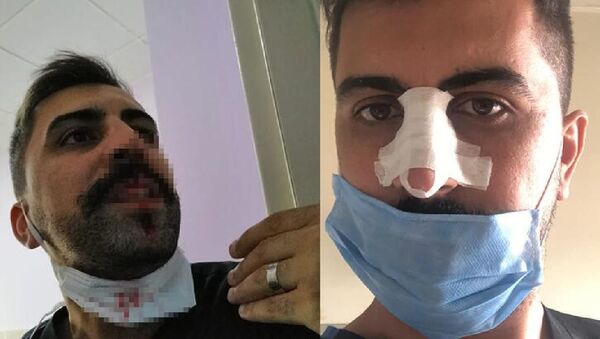 Hasta yakını, sosyal mesafe uyarısı yapan hemşirenin burnunu kırdı - Sinan Doğan - Sputnik Türkiye