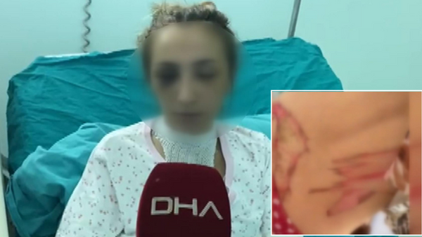 Eşine ısıtılmış bıçakla işkence yapan saldırgan aranıyor - Sputnik Türkiye