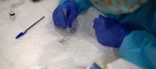 Kovid-19 antikor testi - Sputnik Türkiye