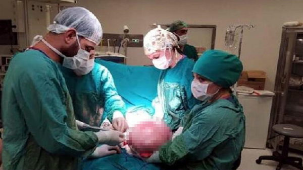 Ağrı şikayetiyle hastaneye giden gencin karnından 9 kilo 800 gramlık kitle çıkarıldı - Sputnik Türkiye