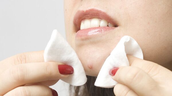 sivilce - Sputnik Türkiye