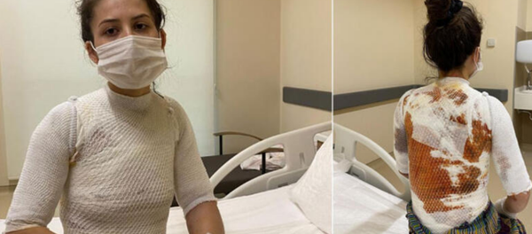 Eşini ve 1.5 yaşındaki kızını kaynar suyla yaktı: - Sputnik Türkiye