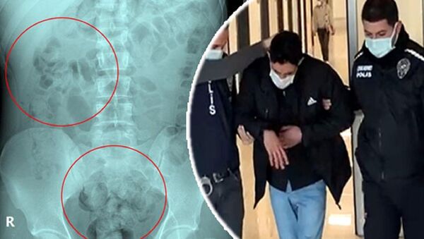  İran uyruklu Zadeh Ahmed Narziveh'in midesinden 890 gram metamfetamin çıktı - Sputnik Türkiye
