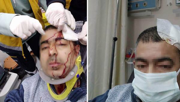 İmamın tabureyle saldırdığı müezzinin kafasına 10 dikiş atıldı - Sputnik Türkiye