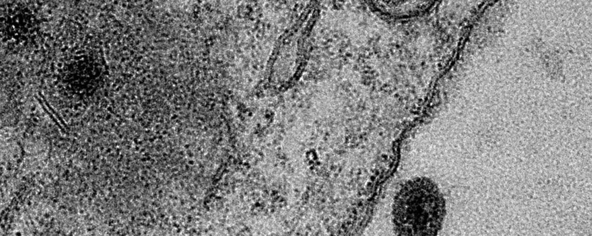 virüs, mikroskop - Sputnik Türkiye, 1920, 25.10.2021