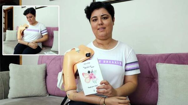 Kanser hastası Meltem, yazdığı kitapla protez koluna kavuştu - Sputnik Türkiye