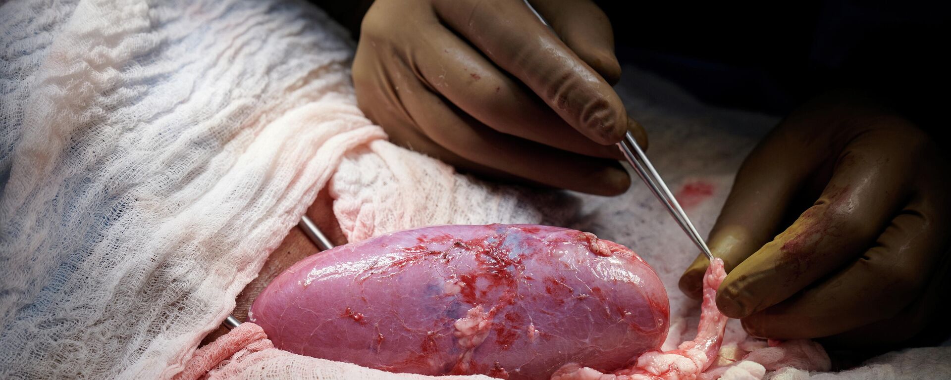 ABD'nin New York Üniversitesi (NYU) Langone Hastanesi'ndeki cerrahlar, hayvandan insana organ nakli için dokuları derhal reddedilme reaksiyonu tetikleyen molekülü içermeyecek şekilde genetiği değiştirilen bir domuzun böbreğini kullandı. Yeni böbrek üç gün boyunca kan damarlarına bağlanıp vücudun dışında tutularak araştırmacıların erişimine açık bırakıldı. - Sputnik Türkiye, 1920, 20.10.2021