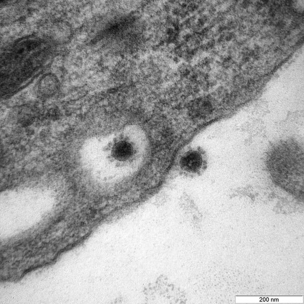 Merkezin açıklamasına göre virüs bir Afrika yeşik maymunu böbreğinin epitel hücre kültüründe yapay olarak büyütüldü. - Sputnik Türkiye