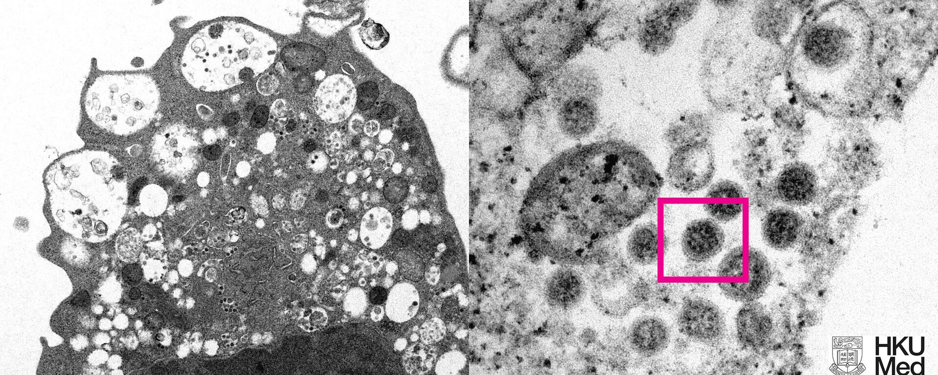 Hong Kong'lu bir grup bilim insanı, koronavirüsün endişe veren yeni varyantı Omicron'un ilk fotoğrafını elde etmeyi başardı.  - Sputnik Türkiye, 1920, 09.12.2021