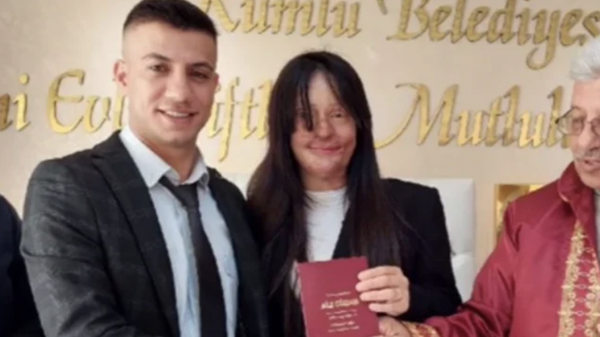 Kadına yönelik şiddetin sembollerinden olan, Türkiye’nin konuştuğu 19 yaşındaki Berfin Özek yüzüne kezzap döken sevgilisi Casim Ozan Çeltik ile evlendi. - Sputnik Türkiye