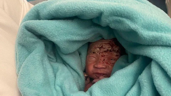 Uçağın tuvalet çöpünde yeni doğmuş bir bebek bulundu - Sputnik Türkiye