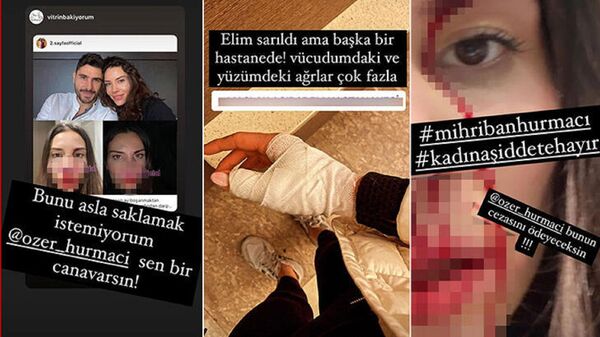 'Futbolcu Özer Hurmacı eşini darp etti' iddiası - Sputnik Türkiye