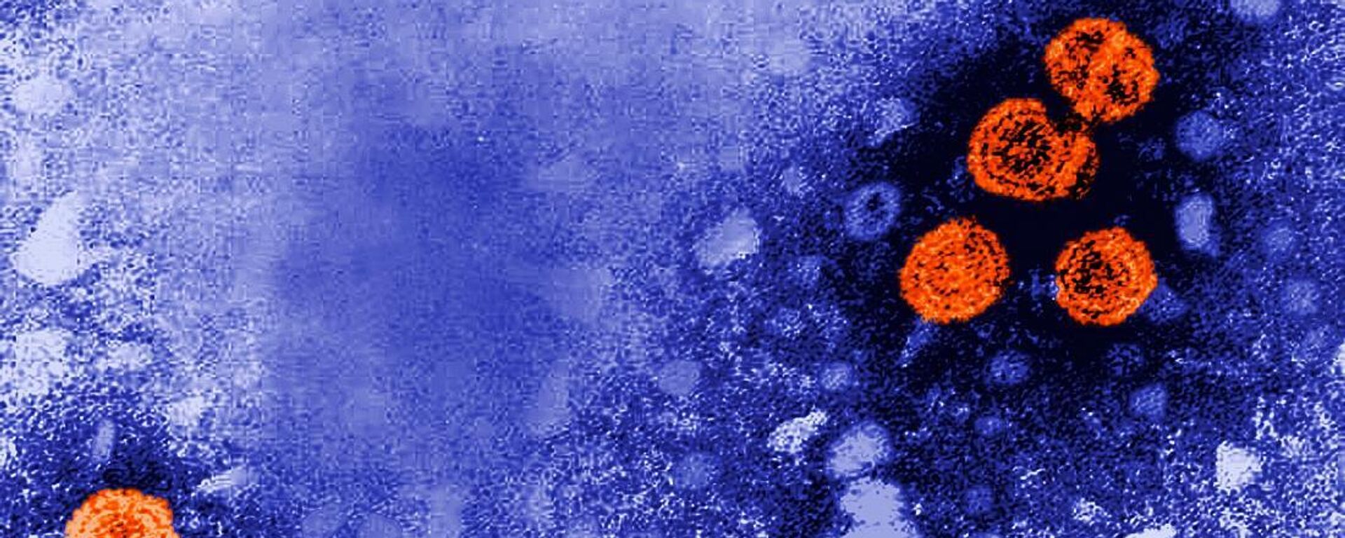 Hepatit B virüsünün mikroskobik görüntüsü - Sputnik Türkiye, 1920, 14.07.2022
