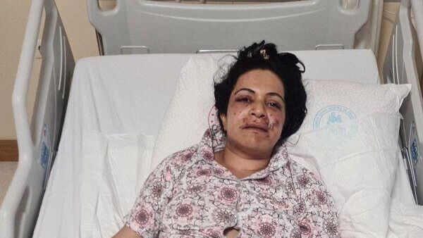 Eltisini sokak ortasında ağzından vurdu - Sputnik Türkiye