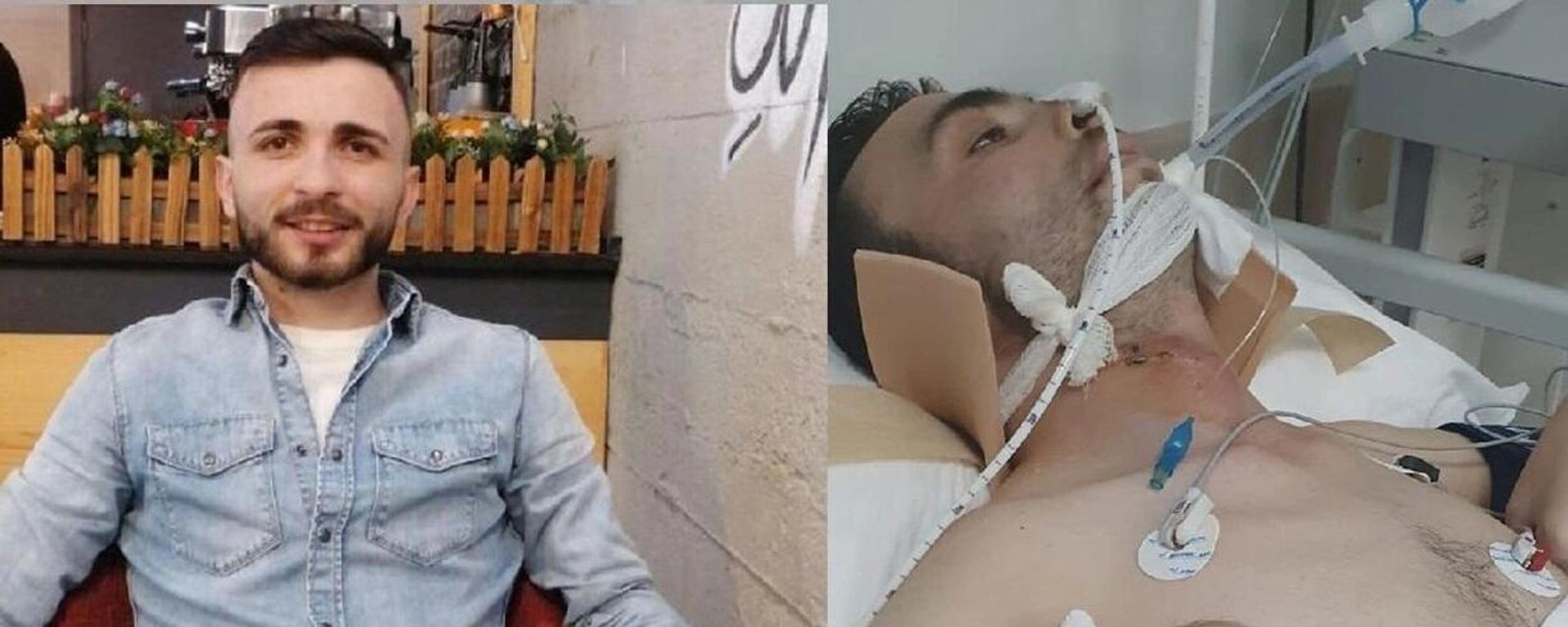 Denize balıklama atlamak istedi, omurgası kırıldı: 51 gündür yoğun bakımda - Sputnik Türkiye, 1920, 08.08.2022