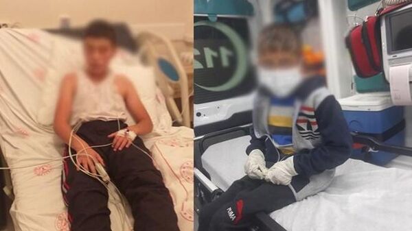 Bitlis'te köpeğin ısırdığı iki çocuktan biri kuduz oldu - Sputnik Türkiye