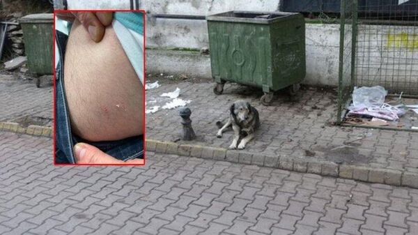 Köpek saldırısına uğrayan adam, kuduz aşısı için 100 km yol gitti - Sputnik Türkiye