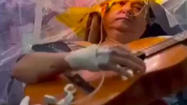 Beyin ameliyatı olurken 4 saat boyunca gitar çaldı  - Sputnik Türkiye