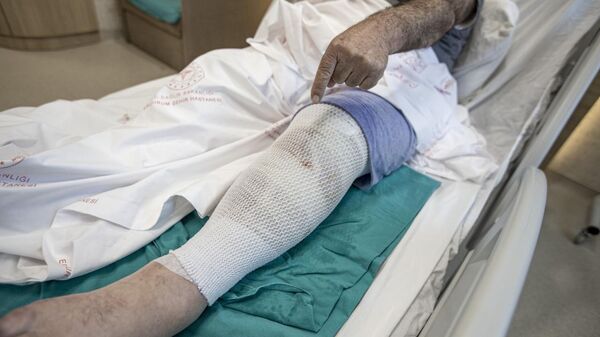 Ağrıyan bacaklarına ısırgan otu sarıp yandı - Sputnik Türkiye