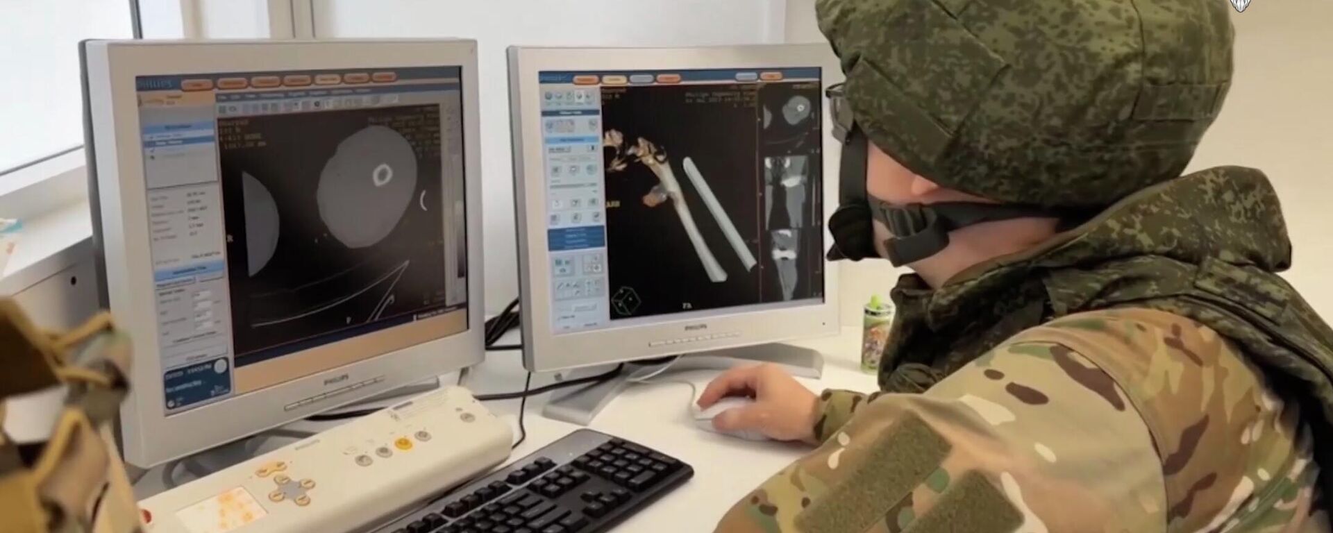 Rus askeri doktolardan inanılmaz ameliyat: Bir askerin bacağından patlamamış mermi çıkarıldı
 - Sputnik Türkiye, 1920, 31.07.2023