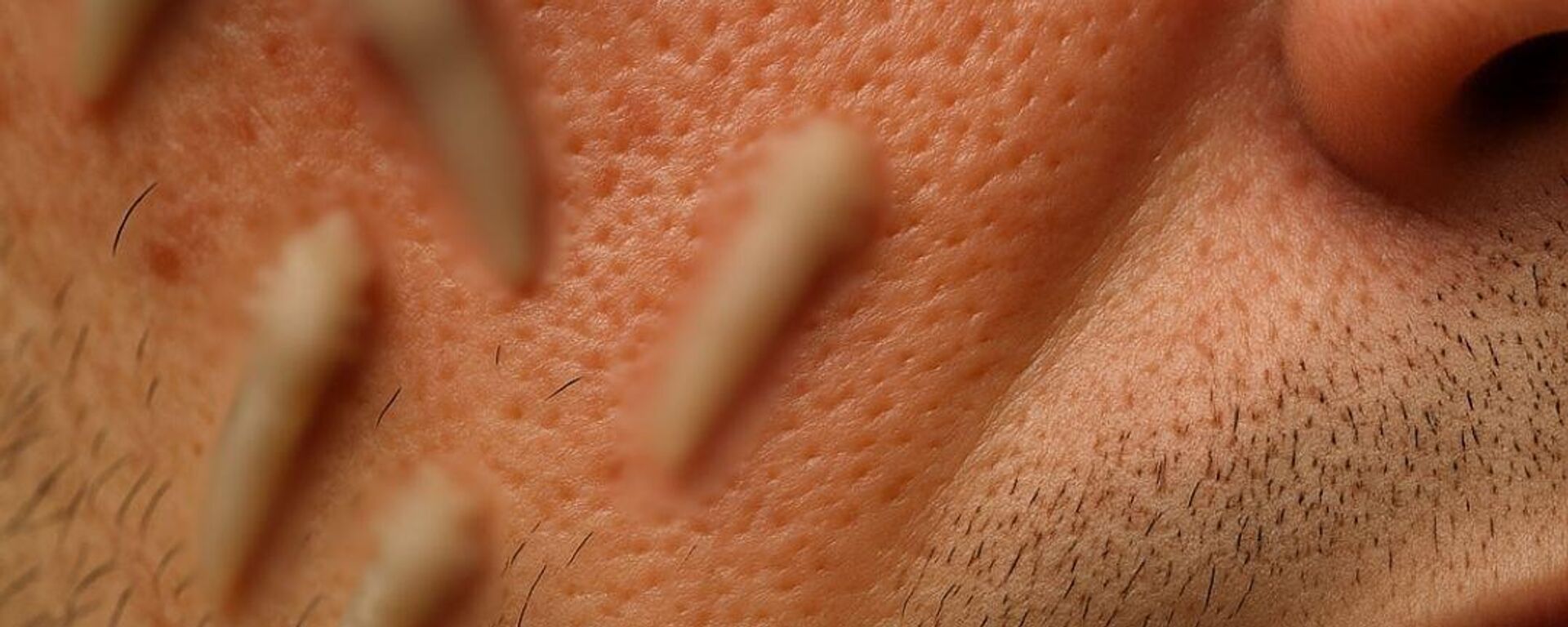 Bilim insanları 'Herkesin cildinde var' diyerek uyardı: Uyurken yüzünüzde milyonlarca '8 bacaklı yaratık' yaşıyor - Sputnik Türkiye, 1920, 02.06.2025