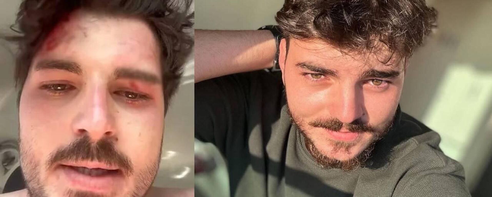 Oyuncu Mehmet Akif Akdeniz darbedildi - Sputnik Türkiye, 1920, 25.06.2025