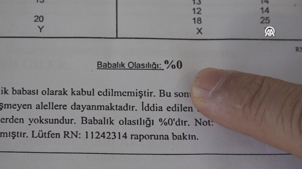 babalık testi - Sputnik Türkiye