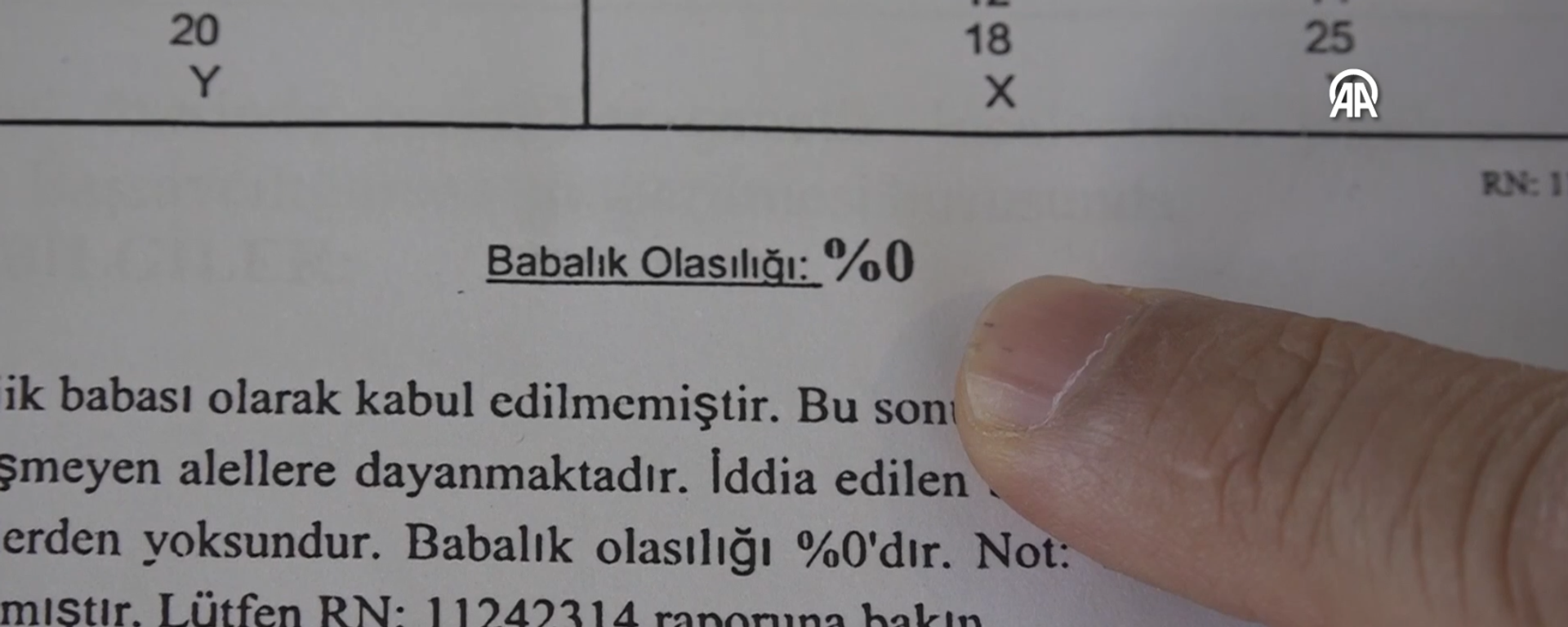 babalık testi - Sputnik Türkiye, 1920, 08.07.2025
